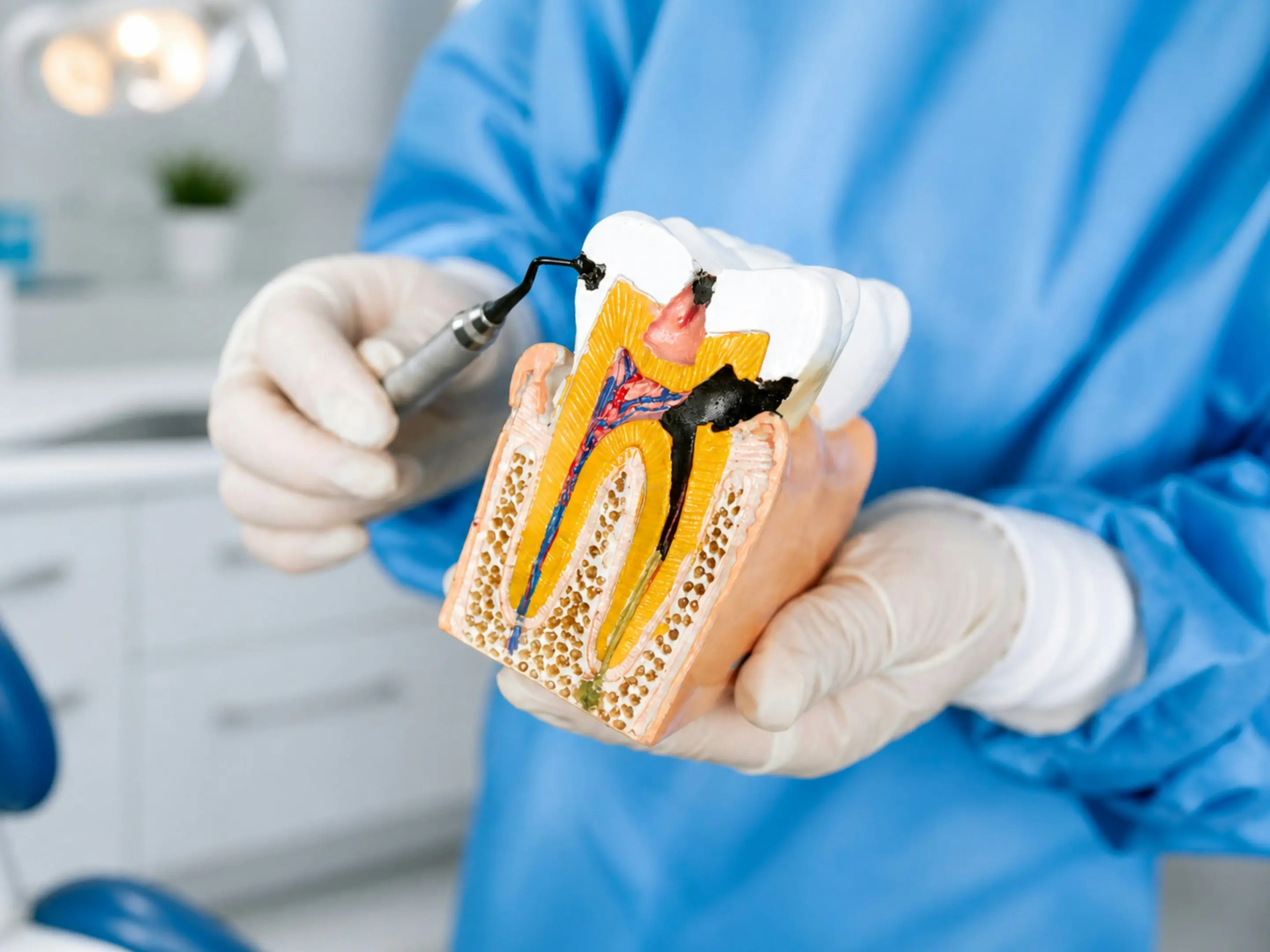 Endodoncia